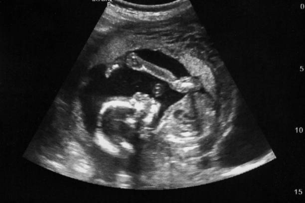 2025年HIV于泰国做试管婴儿所需价格一览
